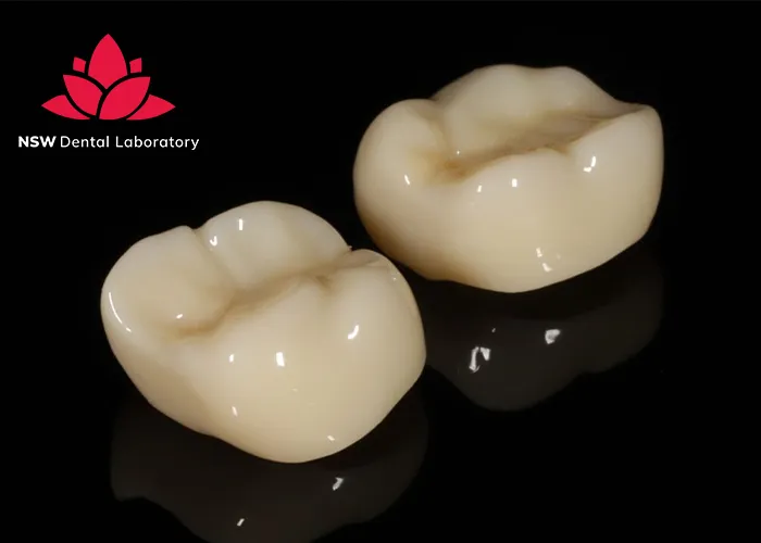 Improved-Your-Smile-With-Dental-Crown-NSW