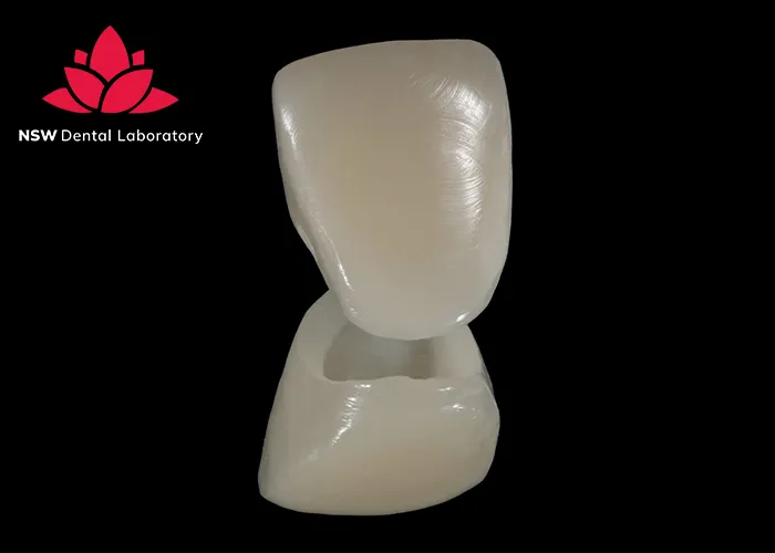 Improved-Your-Smile-With-Dental-Crown-NSW