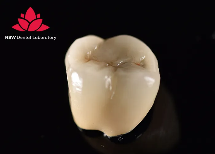 Improved-Your-Smile-With-Dental-Crown-NSW