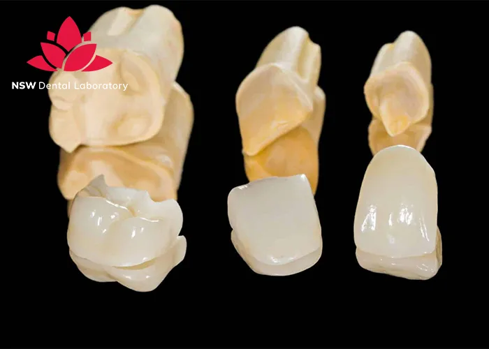 Improved-Your-Smile-With-Dental-Crown-NSW