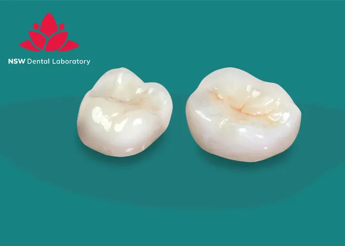 Improved-Your-Smile-With-Dental-Crown-NSW