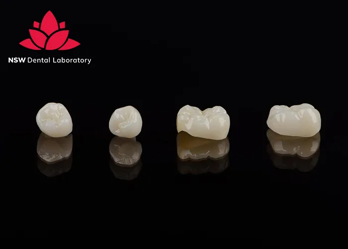 Improved-Your-Smile-With-Dental-Crown-NSW