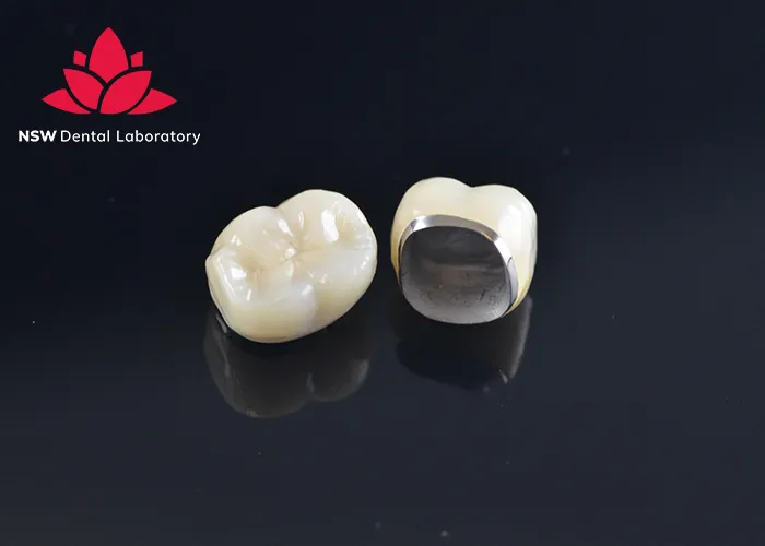 Improved-Your-Smile-With-Dental-Crown-NSW