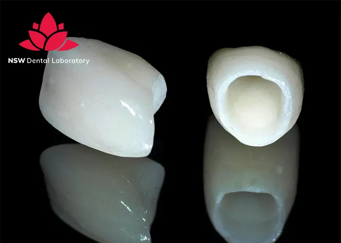 Improved-Your-Smile-With-Dental-Crown-NSW