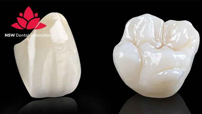 Improved Your Smile With Dental Crown NSW