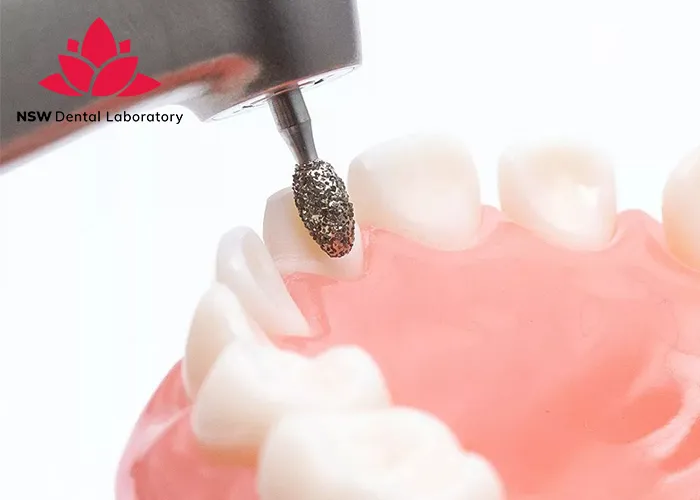 Comprehensive-Guidelines-On-Anterior-Crown-Preparation