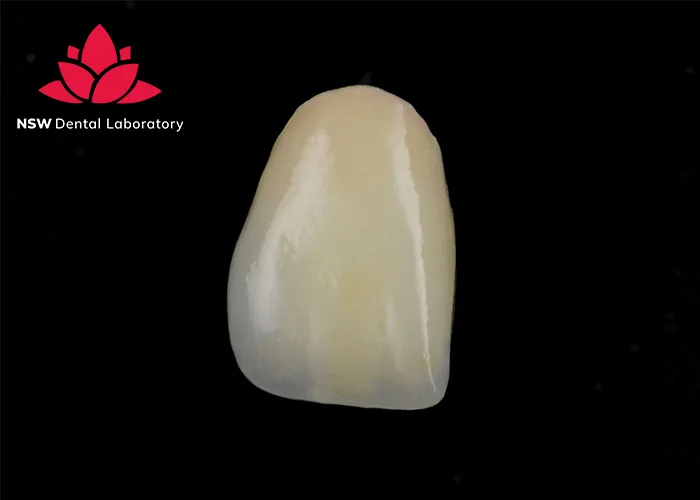 Comprehensive-Guidelines-On-Anterior-Crown-Preparation