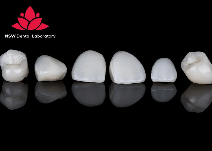 Comprehensive-Guidelines-On-Anterior-Crown-Preparation
