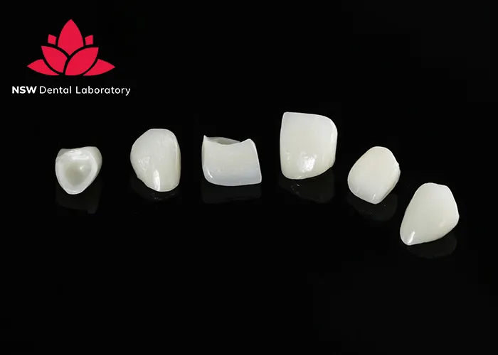 Anterior-Crowns-Done-Right-The-Ultimate-Step-by-Step-Guide