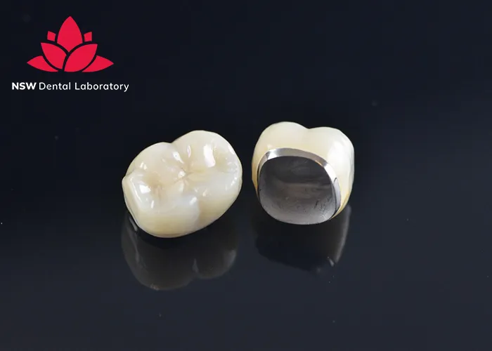 Anterior-Crowns-Done-Right-The-Ultimate-Step-by-Step-Guide