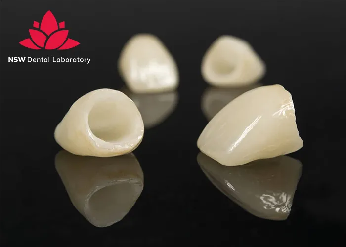 Anterior-Crowns-Done-Right-The-Ultimate-Step-by-Step-Guide