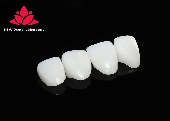 Anterior-Crowns-Done-Right-The-Ultimate-Step-by-Step-Guide