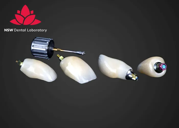 Anterior-Crowns-Done-Right-The-Ultimate-Step-by-Step-Guide