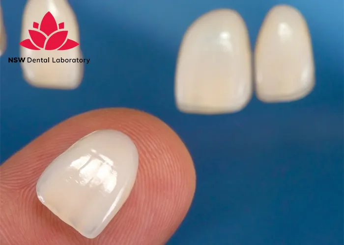 Anterior-Crowns-Done-Right-The-Ultimate-Step-by-Step-Guide