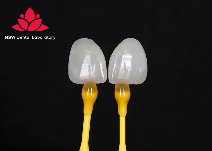 Anterior-Crowns-Done-Right-The-Ultimate-Step-by-Step-Guide