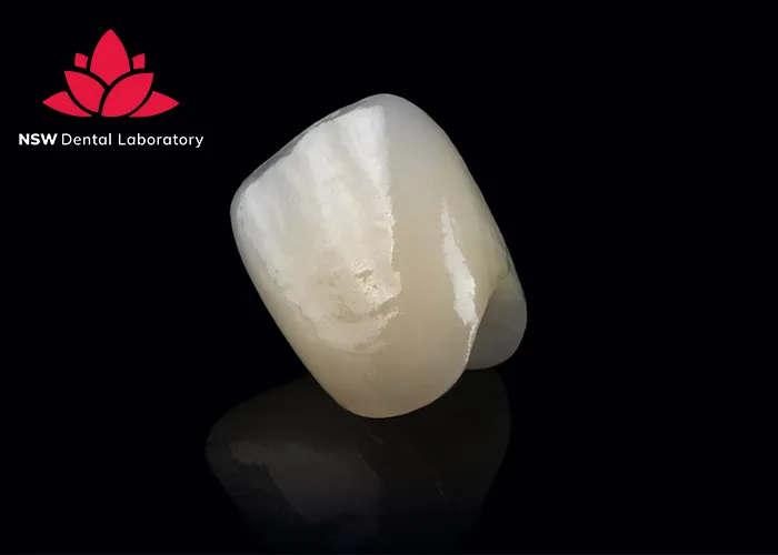 Anterior-Crowns-Done-Right-The-Ultimate-Step-by-Step-Guide