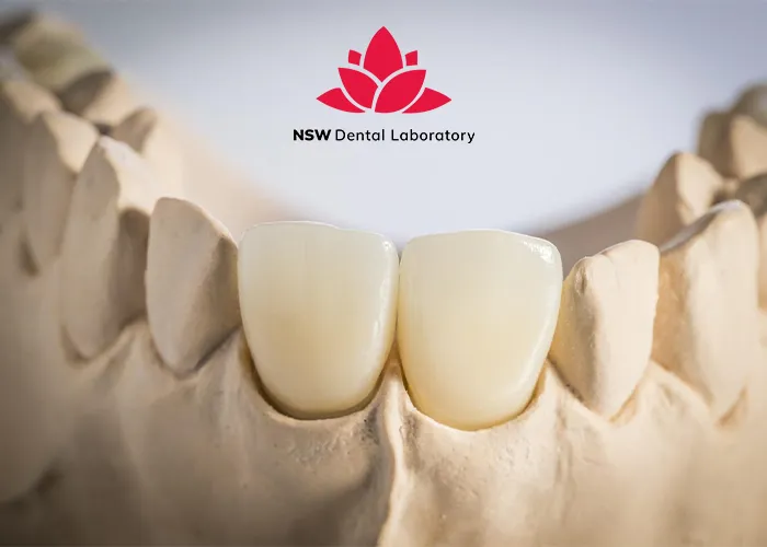 Anterior-Crowns-Done-Right-The-Ultimate-Step-by-Step-Guide