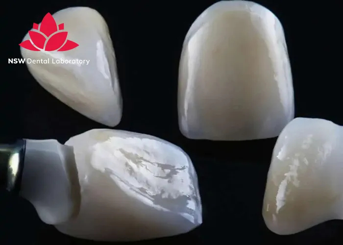 Anterior-Crowns-Done-Right-The-Ultimate-Step-by-Step-Guide