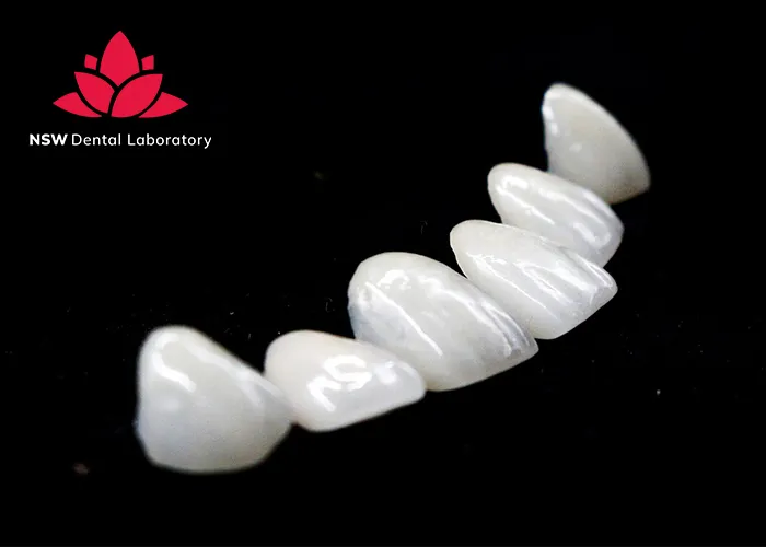 Anterior-Crowns-Done-Right-The-Ultimate-Step-by-Step-Guide