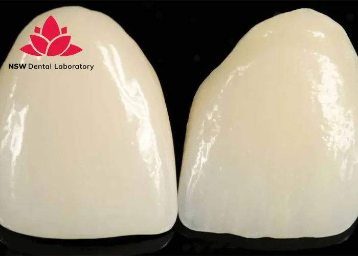 Anterior-Crowns-Done-Right-The-Ultimate-Step-by-Step-Guide