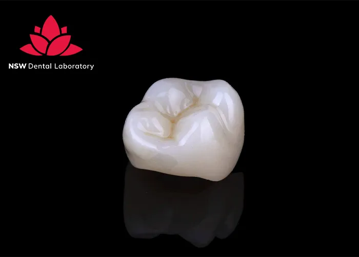 Comprehensive-Comparison-Between-Veneers-And-Crowns