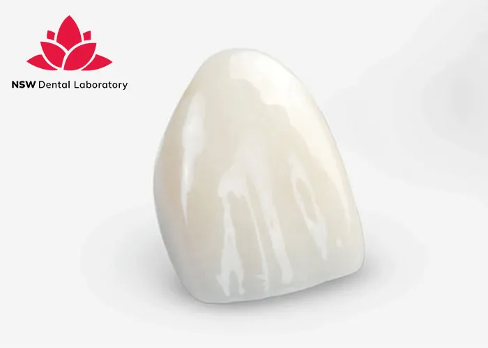Comprehensive-Comparison-Between-Veneers-And-Crowns