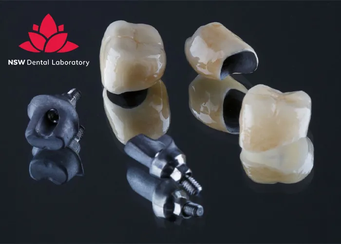 Comprehensive-Comparison-Between-Veneers-And-Crowns
