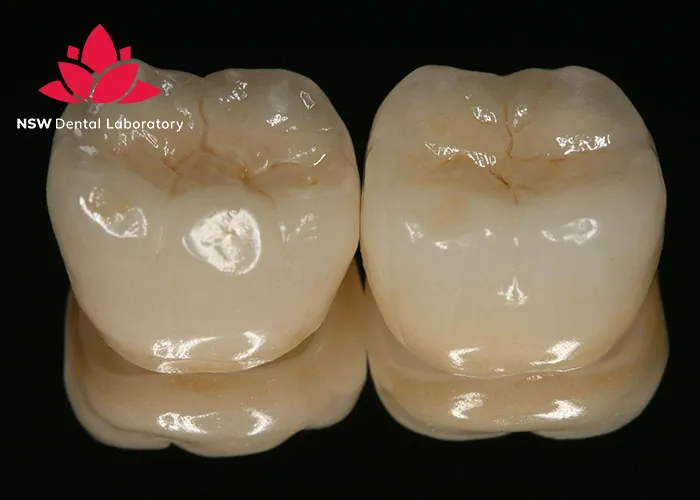 Zirconia-Teeth-Advantages-And-Disadvantages