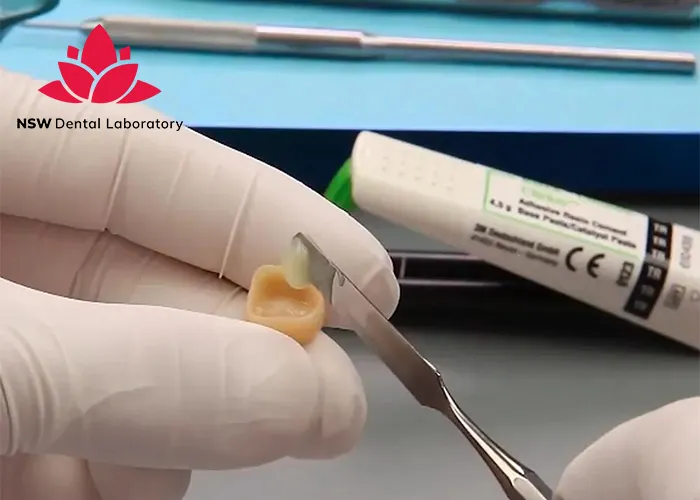 How-To-Achieve-Success-In-Cementing-Zirconia-Crowns?