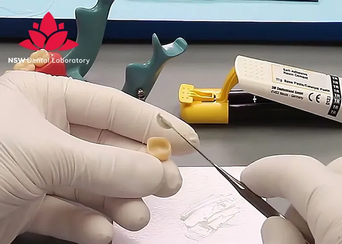 How-To-Achieve-Success-In-Cementing-Zirconia-Crowns?