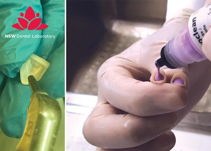 How-To-Achieve-Success-In-Cementing-Zirconia-Crowns?