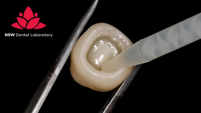 How To Achieve Success In Cementing Zirconia Crowns?