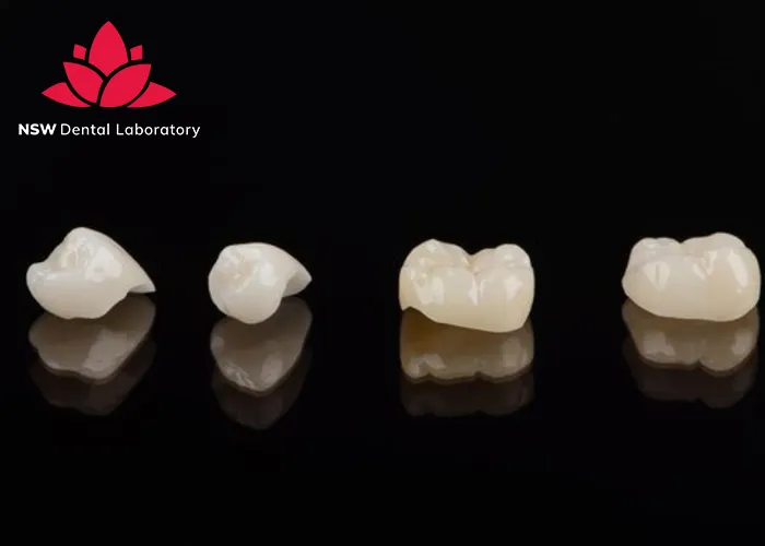 How-To-Achieve-Success-In-Cementing-Zirconia-Crowns?