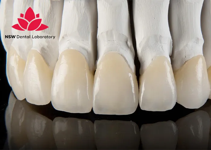 How-To-Achieve-Success-In-Cementing-Zirconia-Crowns?