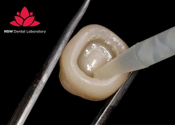 How-To-Achieve-Success-In-Cementing-Zirconia-Crowns?