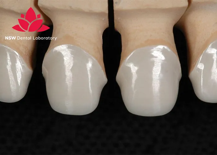 How-To-Achieve-Success-In-Cementing-Zirconia-Crowns?