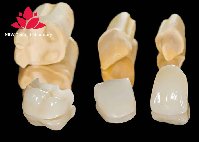 Comprehensive-Guide-About-Ceramic-Crowns-Prosthetics