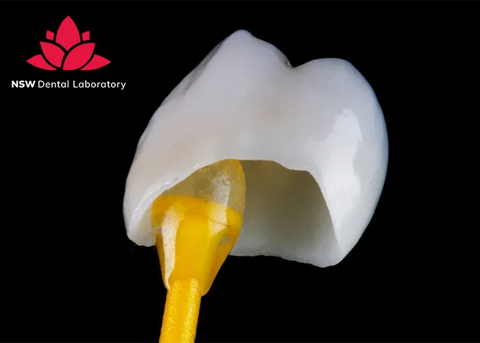 Comprehensive-Guide-About-Ceramic-Crowns-Prosthetics