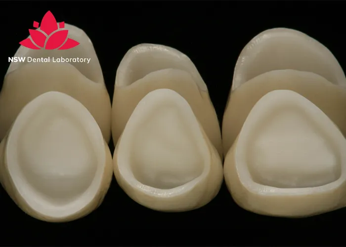 Comprehensive-Guide-About-Ceramic-Crowns-Prosthetics
