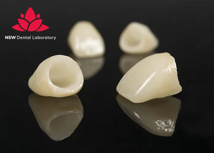 Comprehensive-Guide-About-Ceramic-Crowns-Prosthetics