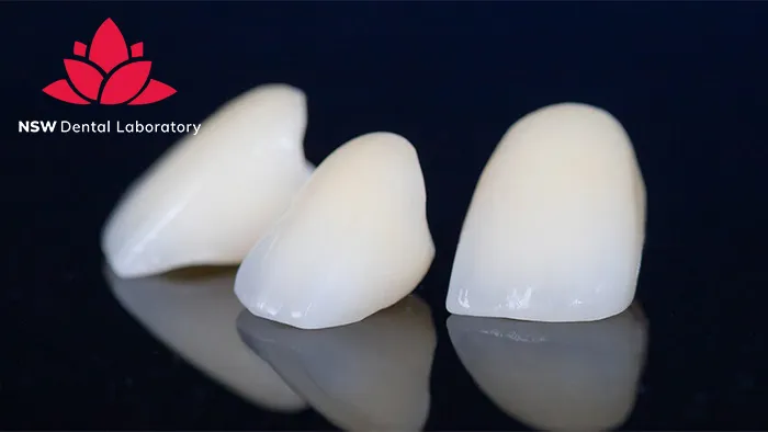Comprehensive Guide About Ceramic Crowns Prosthetics