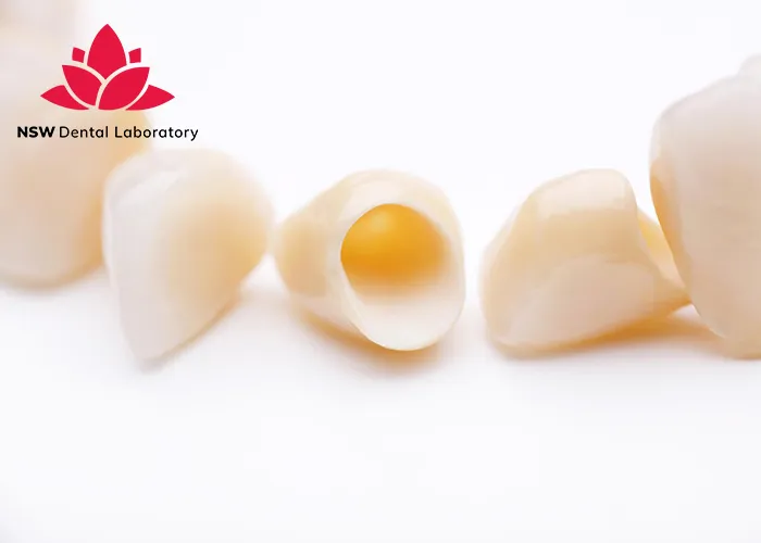 Comprehensive-Guide-About-Ceramic-Crowns-Prosthetics