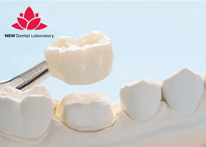 Comprehensive-Guide-About-Ceramic-Crowns-Prosthetics