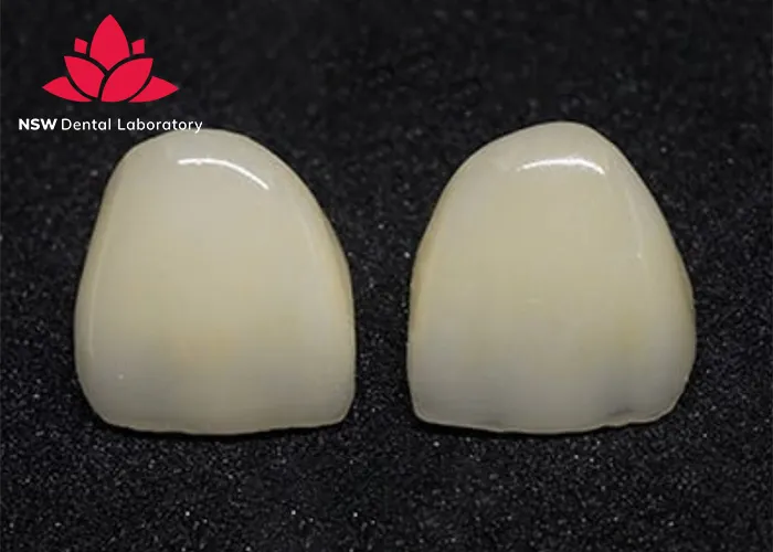 Comprehensive-Guide-About-Ceramic-Crowns-Prosthetics
