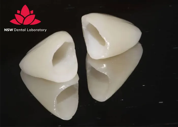 Comprehensive-Guide-About-Ceramic-Crowns-Prosthetics