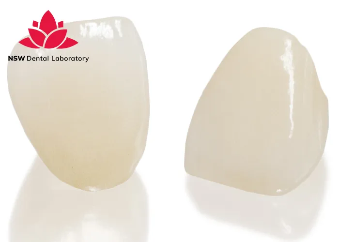 Comprehensive-Guide-About-Ceramic-Crowns-Prosthetics