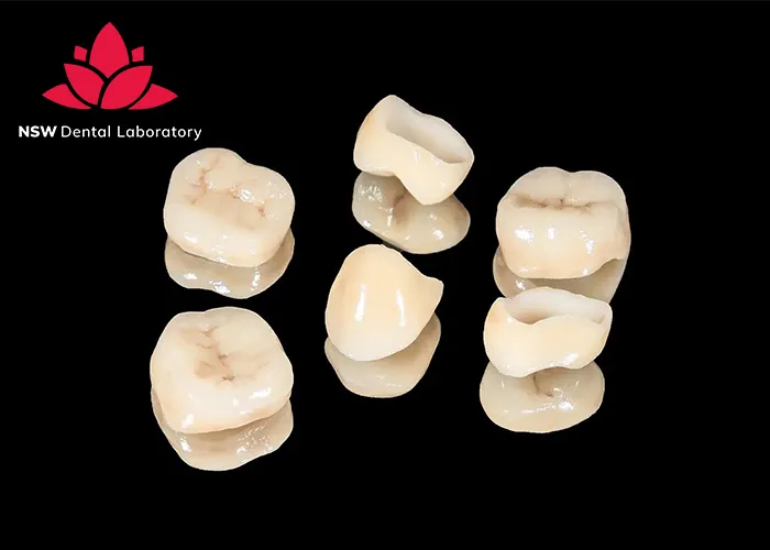 Comprehensive-Guide-About-Ceramic-Crowns-Prosthetics