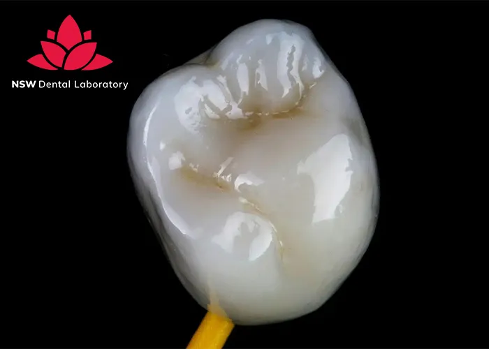 Comprehensive-Guide-About-Ceramic-Crowns-Prosthetics