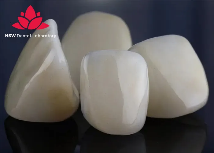 Comprehensive-Guide-About-Ceramic-Crowns-Prosthetics
