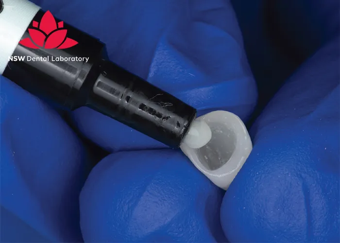 Crown Cementation-Clinical-Guidelines-Tips-and-Best-Practices-for-Success